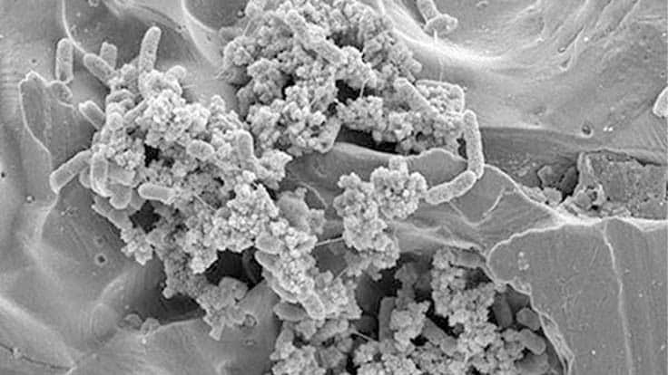 Salmonella biofilm on stainless steel surface
