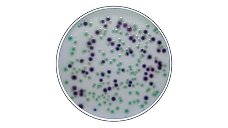 RAPID'E.coli™ 2 Agar offers direct and simultaneous identification of Escherichia coli and total coliforms in drinking and untreated water.